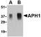Aph-1 Homolog A, Gamma-Secretase Subunit antibody, orb74786, Biorbyt, Western Blot image 