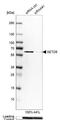 SET Domain Containing 5 antibody, NBP2-38257, Novus Biologicals, Western Blot image 