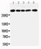 Inositol 1,4,5-Trisphosphate Receptor Type 1 antibody, PA2270, Boster Biological Technology, Western Blot image 