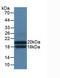 Interleukin 3 Receptor Subunit Alpha antibody, LS-C294905, Lifespan Biosciences, Western Blot image 