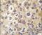 Rho Family GTPase 3 antibody, PA5-14842, Invitrogen Antibodies, Immunohistochemistry frozen image 