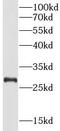 Serine/threonine-protein kinase PINK1, mitochondrial antibody, FNab09992, FineTest, Western Blot image 