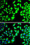 Eukaryotic Translation Initiation Factor 3 Subunit H antibody, LS-C748430, Lifespan Biosciences, Immunofluorescence image 