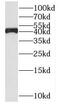 SDS3 Homolog, SIN3A Corepressor Complex Component antibody, FNab08372, FineTest, Western Blot image 