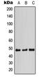 Signal Transducing Adaptor Family Member 2 antibody, LS-C353484, Lifespan Biosciences, Western Blot image 