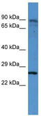 Clathrin Light Chain B antibody, TA342808, Origene, Western Blot image 