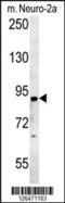 ST18 C2H2C-Type Zinc Finger Transcription Factor antibody, 61-909, ProSci, Western Blot image 