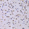 Nuclear Distribution C, Dynein Complex Regulator antibody, LS-C334870, Lifespan Biosciences, Immunohistochemistry paraffin image 