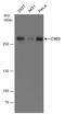 Chromodomain Helicase DNA Binding Protein 3 antibody, GTX131779, GeneTex, Western Blot image 