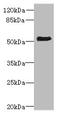 Zinc Finger Protein 212 antibody, A50608-100, Epigentek, Western Blot image 