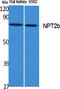 Solute Carrier Family 34 Member 2 antibody, A03957, Boster Biological Technology, Western Blot image 