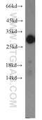 Steroidogenic Acute Regulatory Protein antibody, 12225-1-AP, Proteintech Group, Western Blot image 