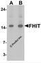 Fragile Histidine Triad Diadenosine Triphosphatase antibody, 7455, ProSci, Western Blot image 
