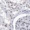 Splicing Factor 3b Subunit 6 antibody, PA5-57077, Invitrogen Antibodies, Immunohistochemistry frozen image 
