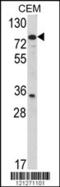 Protein-glutamine gamma-glutamyltransferase 4 antibody, 62-536, ProSci, Western Blot image 