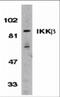 Inhibitor Of Nuclear Factor Kappa B Kinase Subunit Beta antibody, 2121, ProSci, Western Blot image 