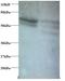 C-C Motif Chemokine Ligand 5 antibody, LS-C211243, Lifespan Biosciences, Western Blot image 