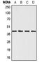 Mitogen-Activated Protein Kinase 12 antibody, MBS821145, MyBioSource, Western Blot image 