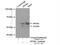 Pyruvate Dehyrogenase Phosphatase Catalytic Subunit 1 antibody, 21176-1-AP, Proteintech Group, Immunoprecipitation image 