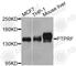 Protein Tyrosine Phosphatase Receptor Type F antibody, A5444, ABclonal Technology, Western Blot image 