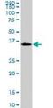 Mesenchyme Homeobox 2 antibody, orb94708, Biorbyt, Western Blot image 