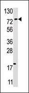 Ubiquitin Specific Peptidase 16 antibody, 61-109, ProSci, Western Blot image 