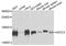 Activating Signal Cointegrator 1 Complex Subunit 3 antibody, A10007, Boster Biological Technology, Western Blot image 