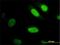 Yes Associated Protein 1 antibody, H00010413-M01, Novus Biologicals, Immunocytochemistry image 