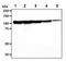 Janus Kinase 2 antibody, GTX57670, GeneTex, Western Blot image 