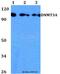 DNA Methyltransferase 3 Alpha antibody, A00136, Boster Biological Technology, Western Blot image 