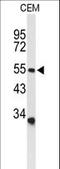 Acid Sensing Ion Channel Subunit 1 antibody, LS-C155923, Lifespan Biosciences, Western Blot image 