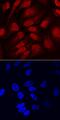 SRY-Box 11 antibody, AF3976, R&D Systems, Immunocytochemistry image 