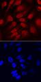 Transcription factor SOX-11 antibody, AF3976, R&D Systems, Immunocytochemistry image 