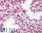 Myocardial Zonula Adherens Protein antibody, LS-B7042, Lifespan Biosciences, Immunohistochemistry paraffin image 