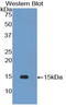 Interleukin 34 antibody, LS-C294910, Lifespan Biosciences, Western Blot image 