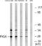 Phosphatidylinositol Glycan Anchor Biosynthesis Class X antibody, GTX87371, GeneTex, Western Blot image 