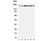 Laminin subunit gamma-1 antibody, R30658, NSJ Bioreagents, Western Blot image 