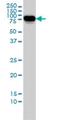 Alkaline Phosphatase, Biomineralization Associated antibody, H00000249-M01, Novus Biologicals, Western Blot image 