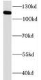 Kinesin Family Member 5B antibody, FNab04567, FineTest, Western Blot image 