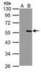 Protein Phosphatase 4 Regulatory Subunit 2 antibody, PA5-31884, Invitrogen Antibodies, Western Blot image 