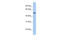 Kruppel Like Factor 11 antibody, 25-430, ProSci, Western Blot image 