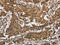 Interleukin 5 Receptor Subunit Alpha antibody, CSB-PA935849, Cusabio, Immunohistochemistry frozen image 