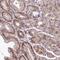 NLR Family Pyrin Domain Containing 14 antibody, NBP1-90627, Novus Biologicals, Immunohistochemistry paraffin image 