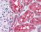 Ribonucleotide Reductase Regulatory Subunit M2 antibody, 51-506, ProSci, Immunohistochemistry paraffin image 