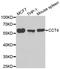 Chaperonin Containing TCP1 Subunit 4 antibody, A07708, Boster Biological Technology, Western Blot image 