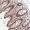 Glyoxylate Reductase 1 Homolog antibody, NBP2-38576, Novus Biologicals, Immunohistochemistry frozen image 