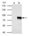 Yes Associated Protein 1 antibody, GTX129151, GeneTex, Immunoprecipitation image 