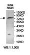 Zinc Finger Protein 33A antibody, orb78084, Biorbyt, Western Blot image 