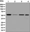 Inosine Monophosphate Dehydrogenase 2 antibody, ab131158, Abcam, Western Blot image 