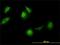 Chaperonin Containing TCP1 Subunit 5 antibody, H00022948-M01, Novus Biologicals, Immunocytochemistry image 